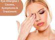 Eye Allergies | Causes, Symptoms & Treatment