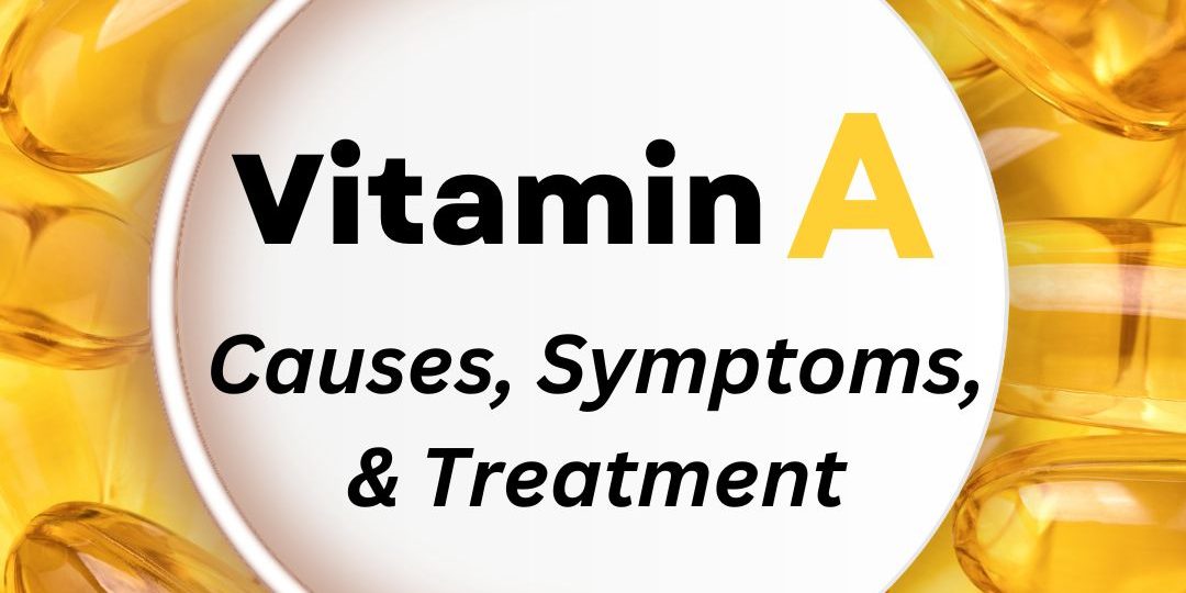 Vitamin A Deficiency: Causes, Symptoms, Treatment Vitamin A Deficiency: Causes, Symptoms, Treatment