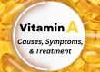 Vitamin A Deficiency: Causes, Symptoms, Treatment