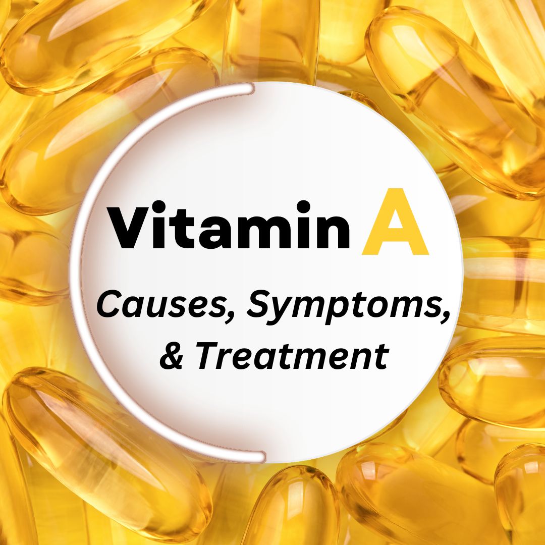 Vitamin A Deficiency: Causes, Symptoms, Treatment Vitamin A Deficiency: Causes, Symptoms, Treatment