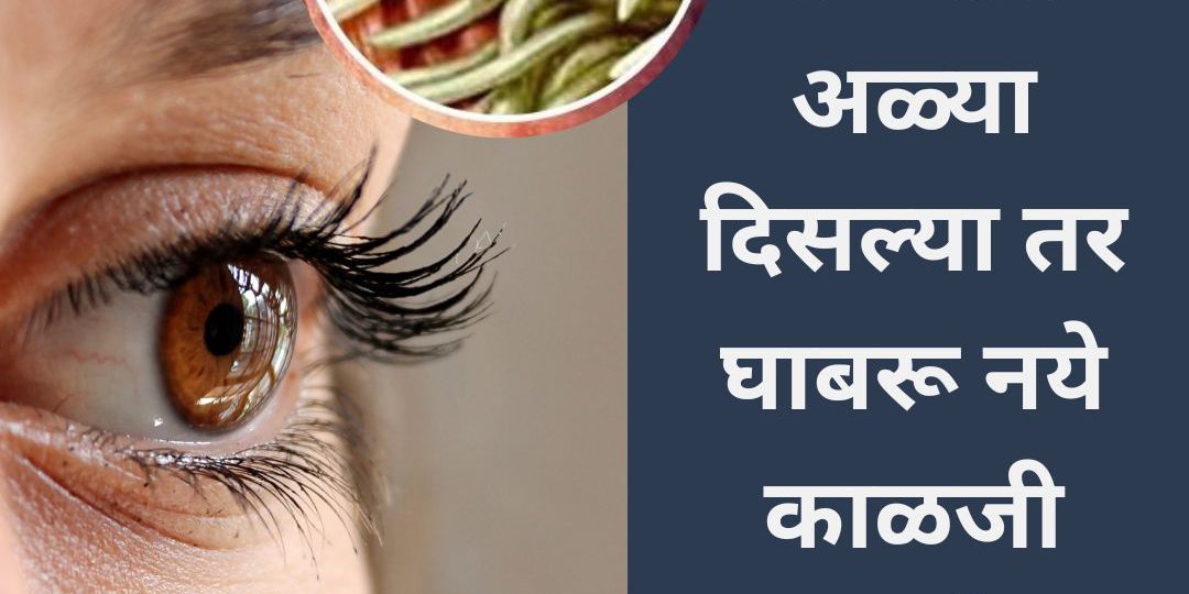 डोळ्यात अळ्या दिसल्या तर घाबरू नये  काळजीने घ्या या उपायांनी डोळ्यात अळ्या दिसल्या तर घाबरू नये काळजीने घ्या या उपायांनी