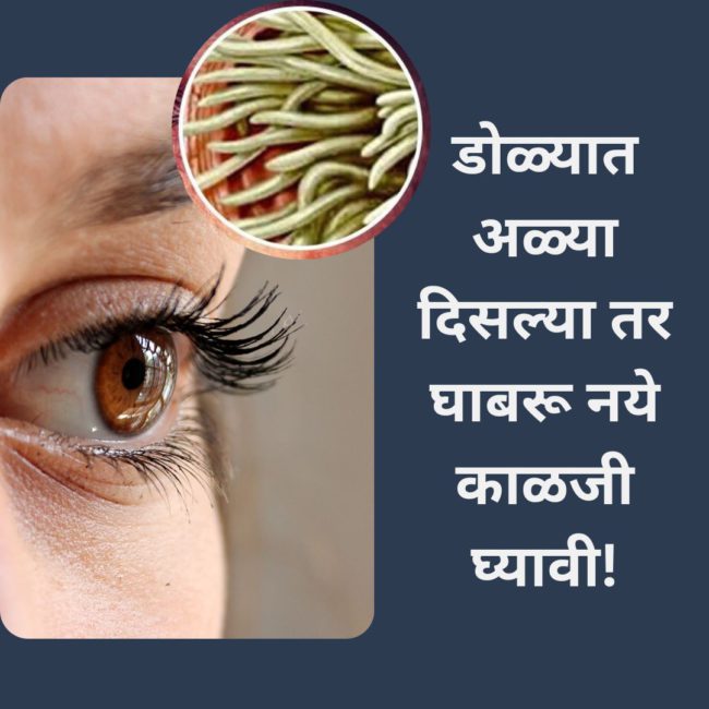 डोळ्यात अळ्या दिसल्या तर घाबरू नये  काळजीने घ्या या उपायांनी डोळ्यात अळ्या दिसल्या तर घाबरू नये काळजीने घ्या या उपायांनी