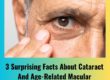 Surprising Facts About Cataract & AMD | Iris Eye Care Moshi