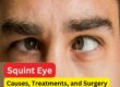 squint eye-causes symptoms and treatment-Iris Eye Care-Dr. Vasundhara Kulkarni