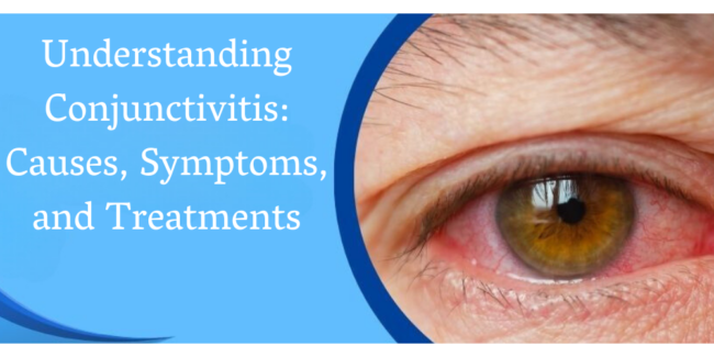 Understanding Conjunctivitis: Causes, Symptoms, and Treatments