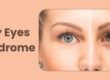 Dry Eyes Syndrome: Causes, Symptoms, and Effective Treatments