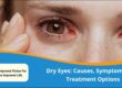 Dry Eyes: Causes, Symptoms, and Treatment