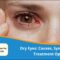 Dry Eyes: Causes, Symptoms, and Treatment