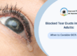 Blocked Tear Ducts in Children & Adults: When to Consider DCR or Probing