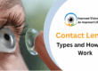 Contact Lenses: Types and How They Work