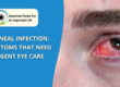 Corneal Infection